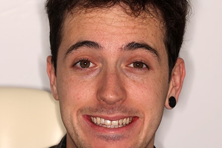After Smile Makeover Treatment Reading Smiles After Smile Makeover Treatment Reading Smiles