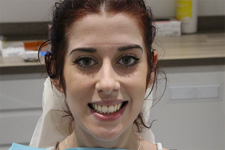 Before Smile Makeover Treatment Reading Smiles Before Smile Makeover Treatment Reading Smiles